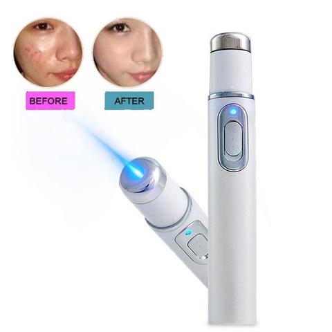 Anti-fungal Home Treatment Set Toe Nail Treatment Pen Heath Blue Light Onychomycosis Paronychia Anti Fungal Fungus Care Repair ► Photo 1/5