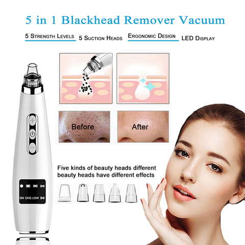 TinWong Blackhead Remover Vacuum,  Electric Facial Comedo Suction Pore Cleaner Extractor Tool,5 Replaceable Suction Heads ► Photo 1/6