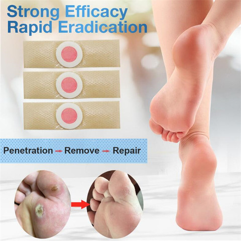 12 Patch Corn Sticker Callus Foot Cushion, Foot Corn Remover Pads