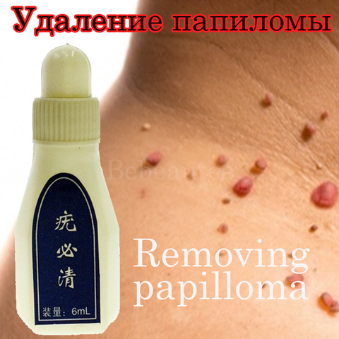 Genital Wart Treatment Papillomas Removal of Warts Draw Liquid From Skin Tags Removing Against Moles Remover Anti Verruca Remedy ► Photo 1/6