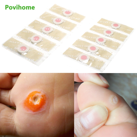 24pcs Foot Corn Plaster Pads Patches Medical Plaster Foot Corn Removal Remover Warts Thorn Callus Corn Foot Care D1467 ► Photo 1/6