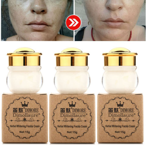 Dimollaure whitening Freckle cream Remova melasma Acne Scars pigment Melanin brown spots sun sopts Retinol cream face cream ► Photo 1/6