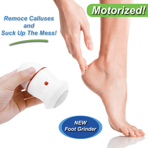 Rechargeable Electric Foot File Pedi VAC Callus Remover for Feet with  Built-in Vacuum Removes Dead Skin From Feet - China Pedi VAC and Electric  Callus Remover price