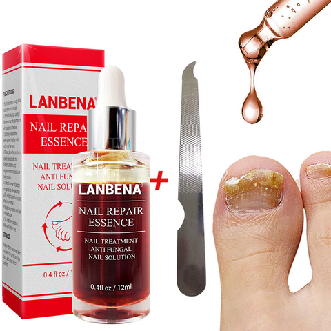 Lanbena Nails Repair Essence Anti Fungal Means for Fungal From Nail Fungus Remedy Treatment Lambena Antihongos on Leg Antifungal ► Photo 1/6
