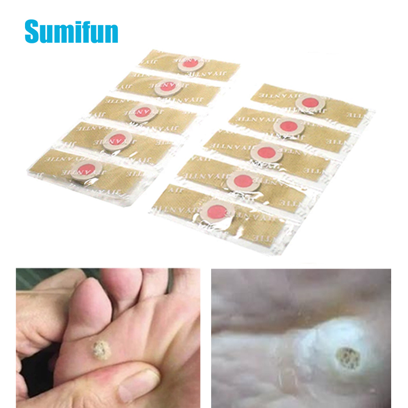 50 Pcs Foot Corn Remover Pads Plantar Wart Thorn Plaster Patch Callus  Removal