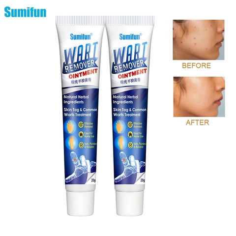 Sumifun 1/2pcs Warts Remover Ointment Skin Tag Remover Thorn Pain Relief Cream Antibacterial Wart Treatment Herbal Extract Patch ► Photo 1/6