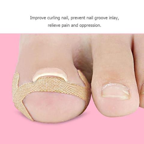 4pcs/Set Ingrown Toenail Corrector Stickers Paronychia Treatment Recover Patch Fixer Pedicure Tools Fingernail Toe Nail Care ► Photo 1/6