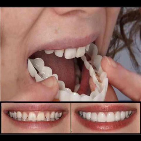 Upper False Fake Tooth Cover Snap On Immediate Smile Cosmetic Denture Care Beauty Tool X7YB ► Photo 1/6