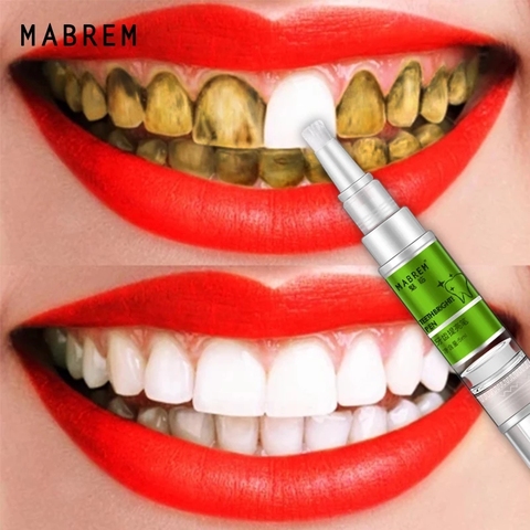 Magic Natural Teeth Whitening Gel Pen Oral Care Remove Stains Tooth Cleaning Teeth Whitener ToolsDental Toothpaste ► Photo 1/6