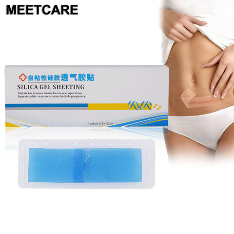 Medical Scar Away Patch Silicone Gel Sheet Wound Marks Removal Cesarean Section Hypertrophic Keloid Skin Scars Therapy Treatment ► Photo 1/6