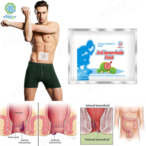 7 Pieces Anti Hemorrhoid Patch Bleeding Anus Itching Patches Piles Anal Fissure Plaster Internal/External Hemorrhoids Therapy ► Photo 1/6
