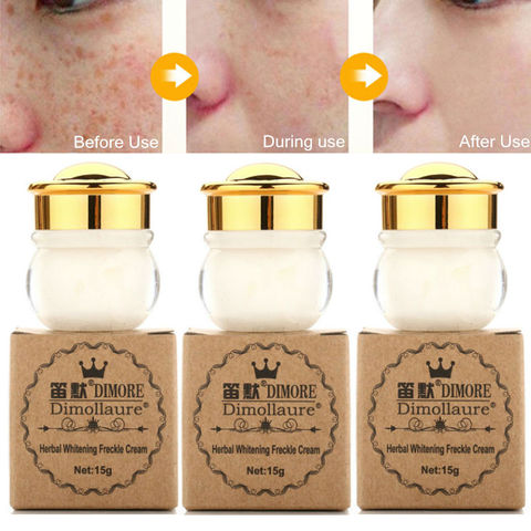 Dimollaure whitening Freckle Cream Remova Melasma Acne Scars Pigment Melanin scar removal face cream Dimore ► Photo 1/6