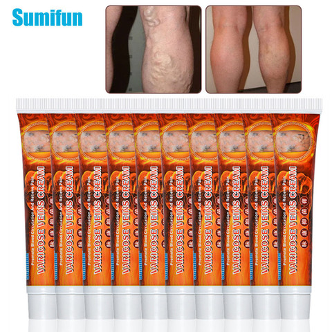 10pcs Sumifun Varicose Veins Ointment Medical Plaster Skin Care Treatment Vasculitis Phlebitis Spider Varicosity Angiitis Creams ► Photo 1/6