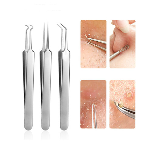 3 Pcs/lot Acne Needle Tweezers Blackhead Blemish Pimples Removal Pointed Bend Gib Head Face Care Tools Comedone Acne Extractor ► Photo 1/5