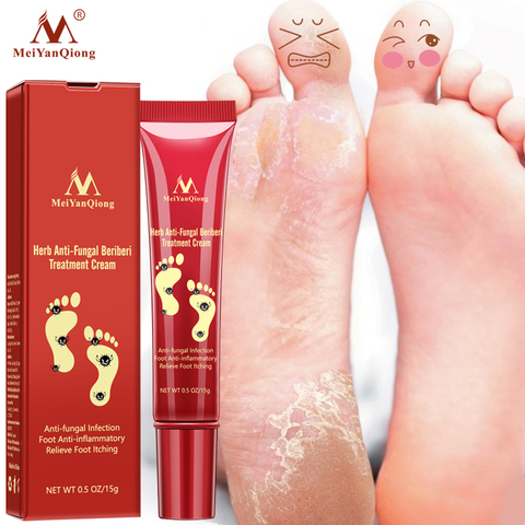Foot Care Cream Foot spa Pedicure Herbal Detox Anti Fungal Infection Onychomycosis Fungus Treatment   For legs ► Photo 1/6