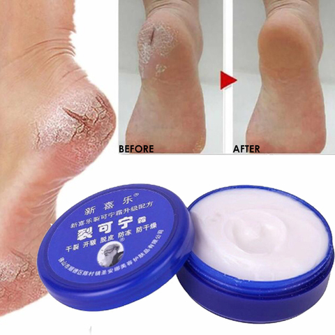 Traditional Chinese Oil Anti-Drying Crack Foot Cream Heel Cracked Repair Cream Removal Dead Skin Hand Feet Care Ointment 33g ► Photo 1/1