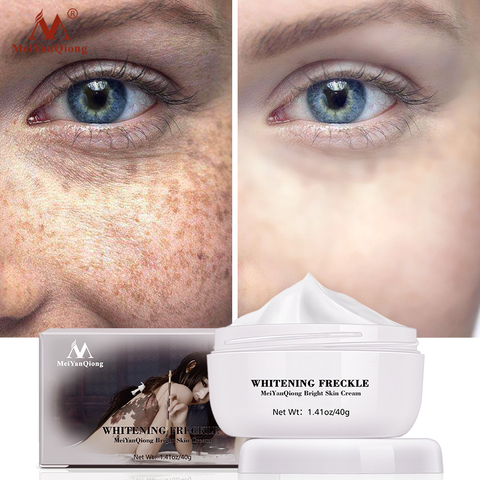 Meiyanqiong Anti Aging Face Care Cream Dark Spot Remover Skin Lightening Cream Dark Skin Care Anti Freckle  Whitening Cream ► Photo 1/6