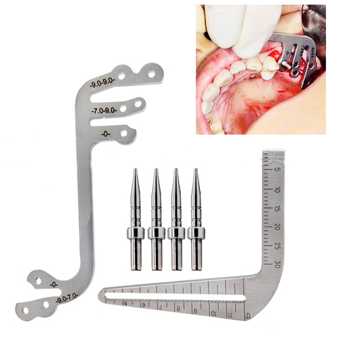 Dental Implant Guide Set Oral Planting Locator Positioning Guide Drilling Positioning Ruler Angle Ruler Implant Tools Dentist ► Photo 1/5