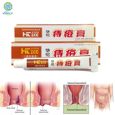 Hua Tuo Hemorrhoids Ointment Chinese Herbal Hemorrhoids Cream External Anal Fissure Medical Plaster Health Care Pain Relief ► Photo 1/6