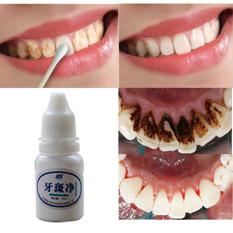 10ml Teeth Whitening Water Oral Hygiene Cleaning Teeth Care Tooth Cleaning Whitening Water Clareamento Dental Odontologia 1PC ► Photo 1/6