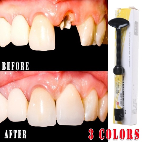 Dental A1 2 3 Tree Resin Universal Radiopaque Oral Care Restorative Shade Low Shrinkage Micro Hybrid Composite Light Cured ► Photo 1/6