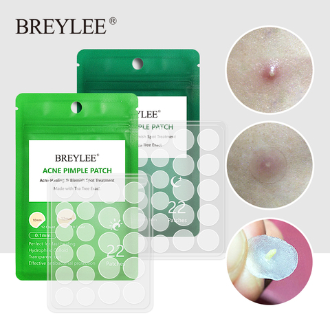 BREYLEE Acne Pimple Patch  Stickers Acne Treatment Pimple Remover Tool Blemish Spot Facial Mask Skin Care  Waterproof 22 Patches ► Photo 1/6