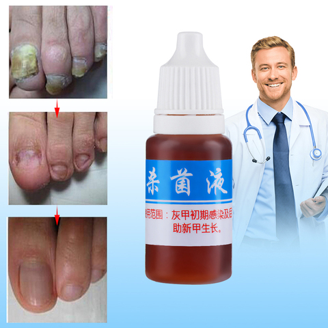 10ml Fungal Nail Treatment Essence Nail Foot Whitening Toe Fungus Removal Feet Care Nail Gel for Onychomycosis  ► Photo 1/5