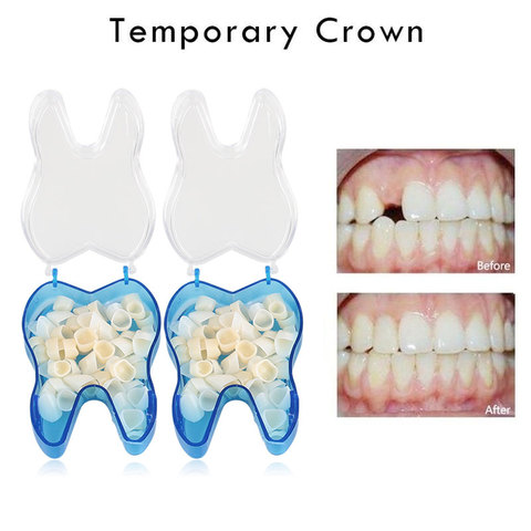 50pcs Dental Temporary Crown 25pcs Teeth Anterior + 25pcs Posterior Dentist Materials Dental Tools Dentistry Equipment ► Photo 1/6