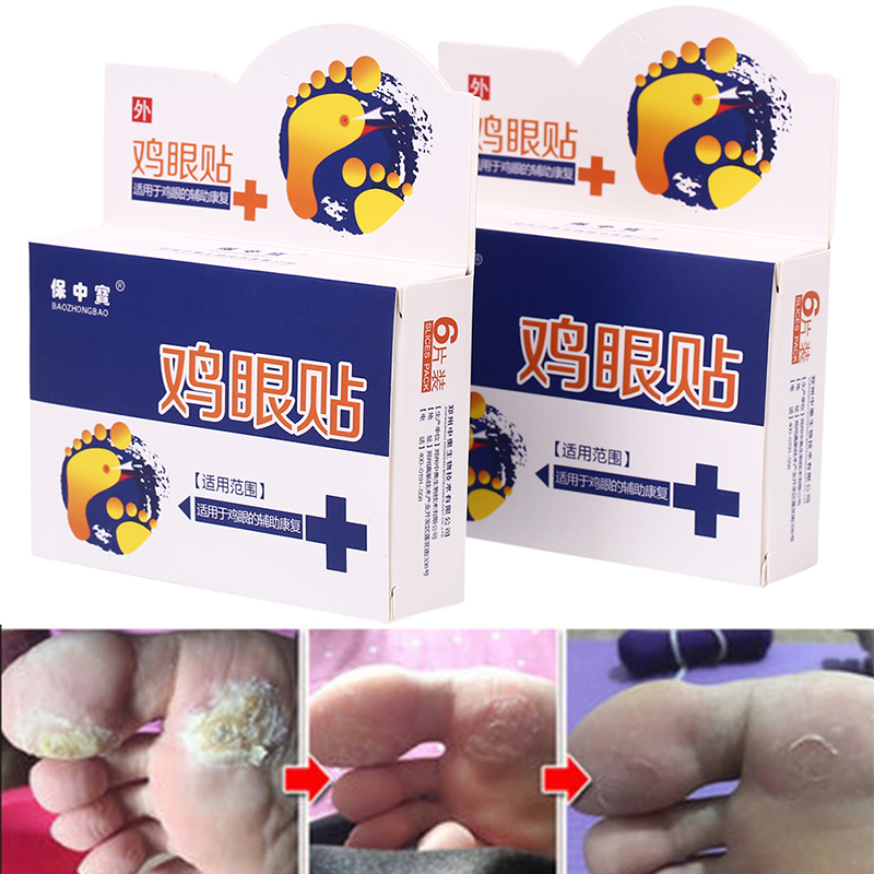Foot Corn Removal Medical Plaster Foot Pad Patch Dead Skin Callus