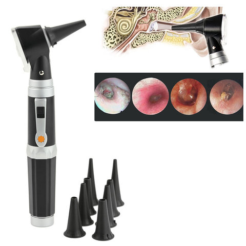 High Quality Professional Otoscopio Diagnostic Kit Medical Ear Care Endoscope LED Portable Otoscope ► Photo 1/6