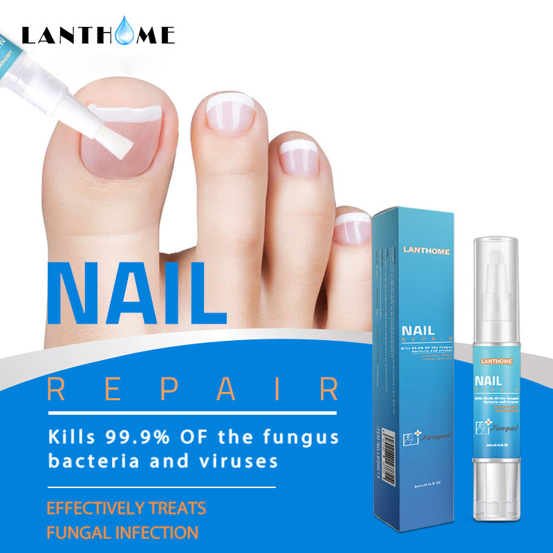 Buy Online Powerful Nail Treatment Pen Onychomycosis Paronychia Anti Fungal Nail Infection Chinese Herbal Toe Fungus Care Repair Serum Alitools
