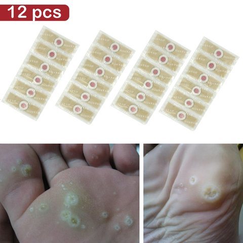 12PCS  Medical Plaster Foot Corn Removal Warts Thorn patches  Corn of foot Calluses Callosity Detox clavus  Medical Patch ► Photo 1/6