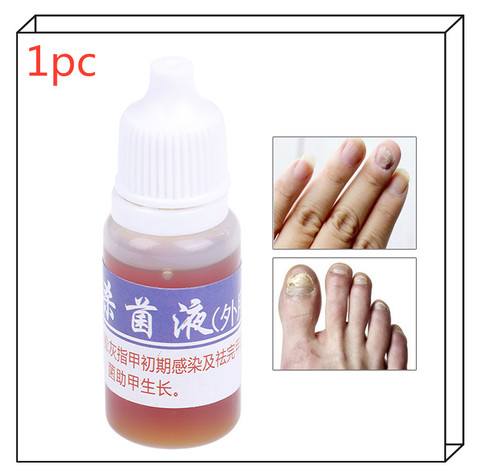 1Pc Toenail Fungus Removal Anti Infection Paronychia Foot Whitening Onychomycosis Useful Fungal Nail Treatment Feet Care Essence ► Photo 1/6