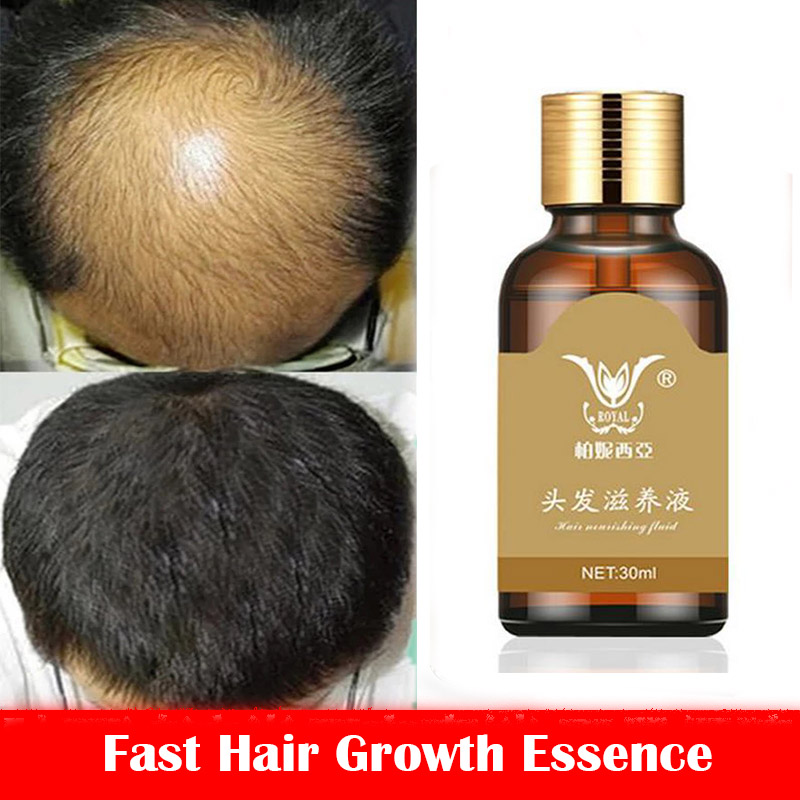 Fast Hair Growth Essence Hair Loss Products Hair Growth Fibras Cabelo  Shampoo Cremes De Tratamento Para Cabelos Hair Care - Price history &  Review | AliExpress Seller - All Beautiful Store 