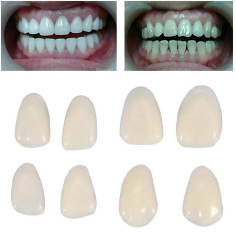 50Pcs/Box Oral Care Dental Temporary Teeth Anterior Molar Crown