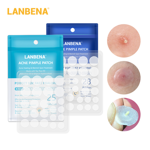 LANBENA Acne Pimple Patch  Invisible Acne Stickers Blemish Treatment Acne Master Pimple Remover Beauty Tool Skin Care ► Photo 1/6
