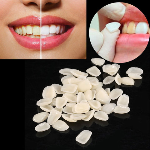 70Pcs  Crown Ultra-Thin Tooth Patch Resin Temporary teeth for Anterior Teeth Veneers Provisionals ► Photo 1/6