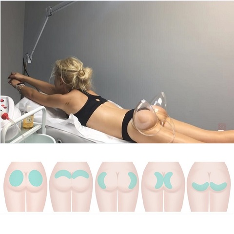 Hot sale buttocks lifter cup vacuum breast enlargement therapy cupping machine bigger butt hip enhancer machine ► Photo 1/6