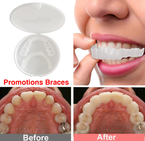 1set Perfect Fit Teeth Whitening Fake Tooth Cover Snap On Silicone Smile Veneers Teeth Upper Beauty Tool Lower Teeth Upper teeth ► Photo 1/6