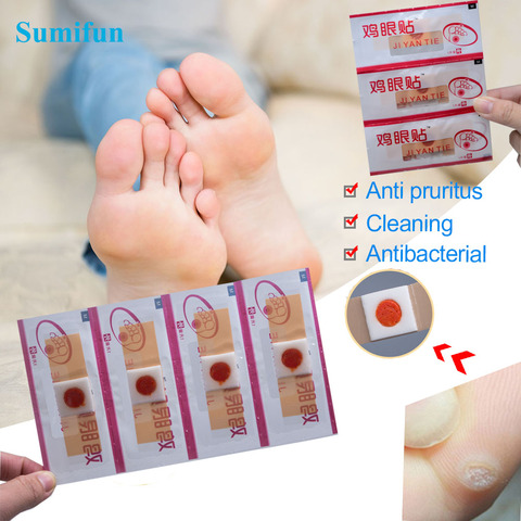 6/12/24/36pcs Foot Toe Corn Removal Patches Warts Thorn Feet Callus Chicken Eye Treatment Sticker Pain Relief Medical Plaster ► Photo 1/6