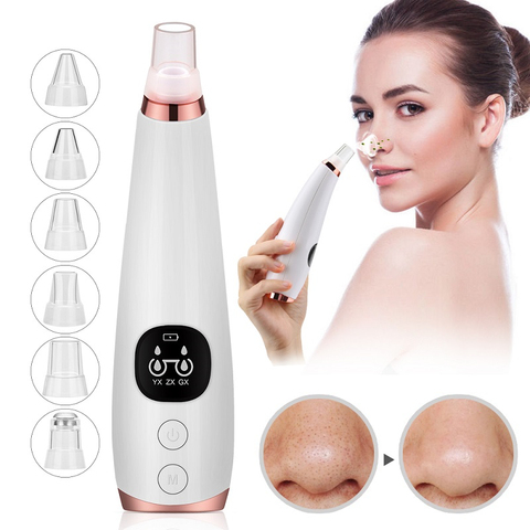 Blackhead Remover Nose T Zone Pore Vacuum Acne Pimple Removal Vacuum Suction Tool Facial Diamond Dermabrasion Machine Face Clean ► Photo 1/6