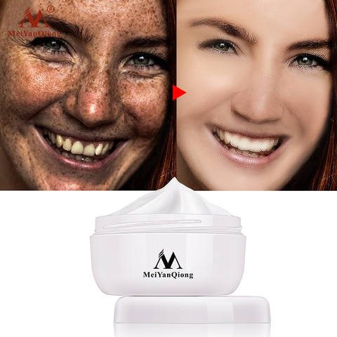 Strong Effects Skin Whitening Cream Powerful Whitening Freckle Cream Remove Melasma Acne Spots Pigment Melanin Moisturizing 40g ► Photo 1/6