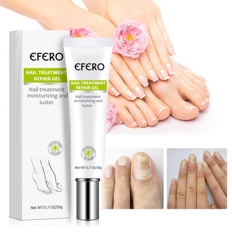 efero Fungal Nail Serum Repair Essence Foot Nail Fungus Removal Gel Anti Infection Paronychia Onychomycosis Nail Treatment ► Photo 1/6