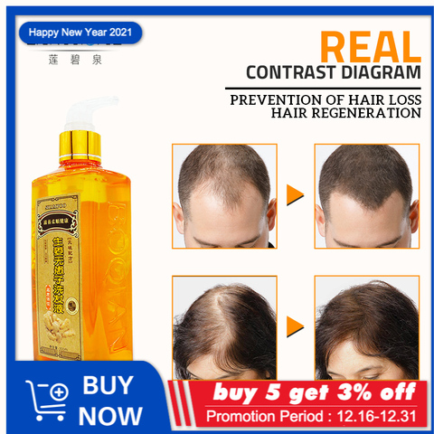 300ml Ginger Shampoo Anti Hair Baldness Antihair Loss Dandruff Black Shampoos Professional Grow Thick Hairs Growth Products ► Photo 1/6
