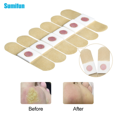 12/24/36Pcs Foot Corn Remover Painless Feet Care Patch Warts Thorn Medical Plaster Feet Callus Removal Tool Soften Skin D2399 ► Photo 1/6