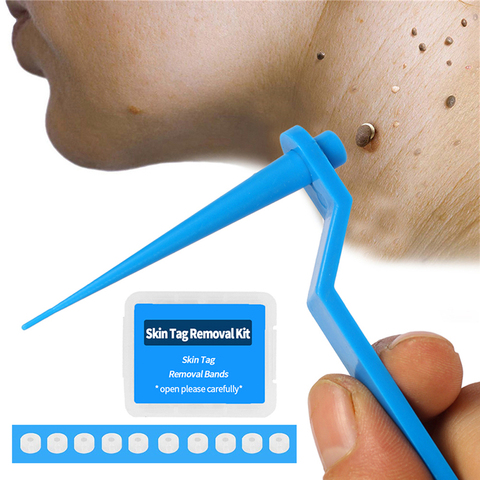 Micro Band Non Toxic Face Care Mole Wart Tool For Small To Medium Blue Skin Tag Removal Kit With Cleansing Swabs Home Use Adult ► Photo 1/6