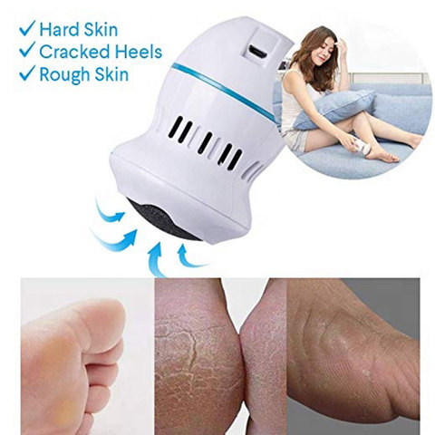 Foot Grinding File Electric Feet Callus Removers USB Charging Grinding Head Foot Pedicure Tools for Dead Hard Cracked Dry Skin ► Photo 1/6