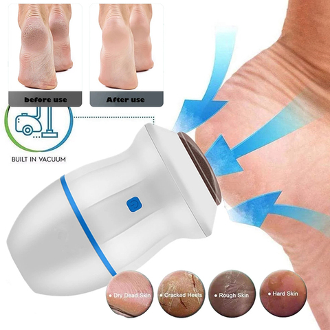 New Electric Vacuum Foot Grinder File Machine Exfoliate Dead Skin Callus Remover Heel Removal Scraper Vacuums  Grinding Head ► Photo 1/6