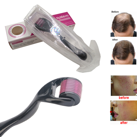 Derma Roller DRS 540 Micro Needle Microneedle Skin Care Treatment Scalp Hair Beard Growth MesoRollor Agulha Mento Mezoroller ► Photo 1/6