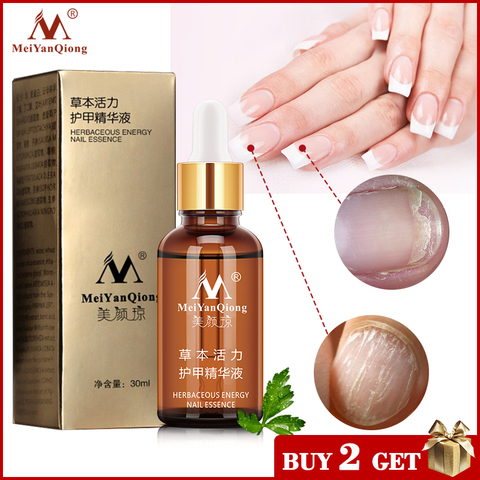 Nail Fungal Treatment Feet Care Essence Nail Foot Whitening Toe Nail Fungus Removal Gel Anti Infection Paronychia Onychomycosis ► Photo 1/6